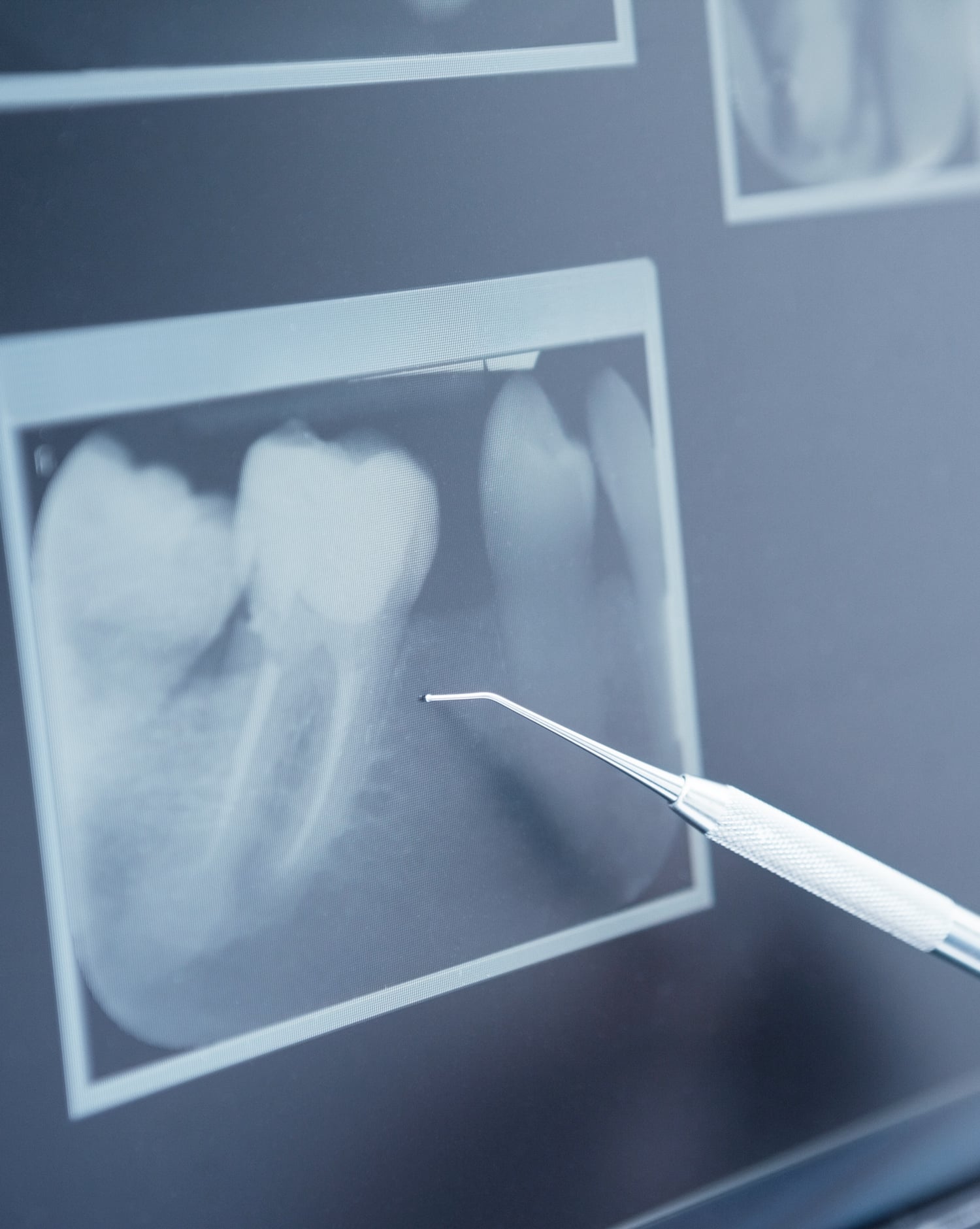 dental xray at oxford dental