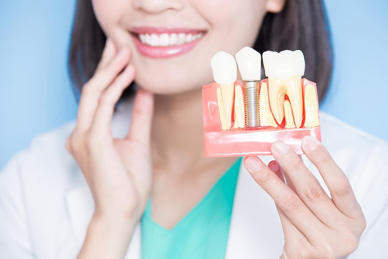 woman holding dental implant model while holding her teeth