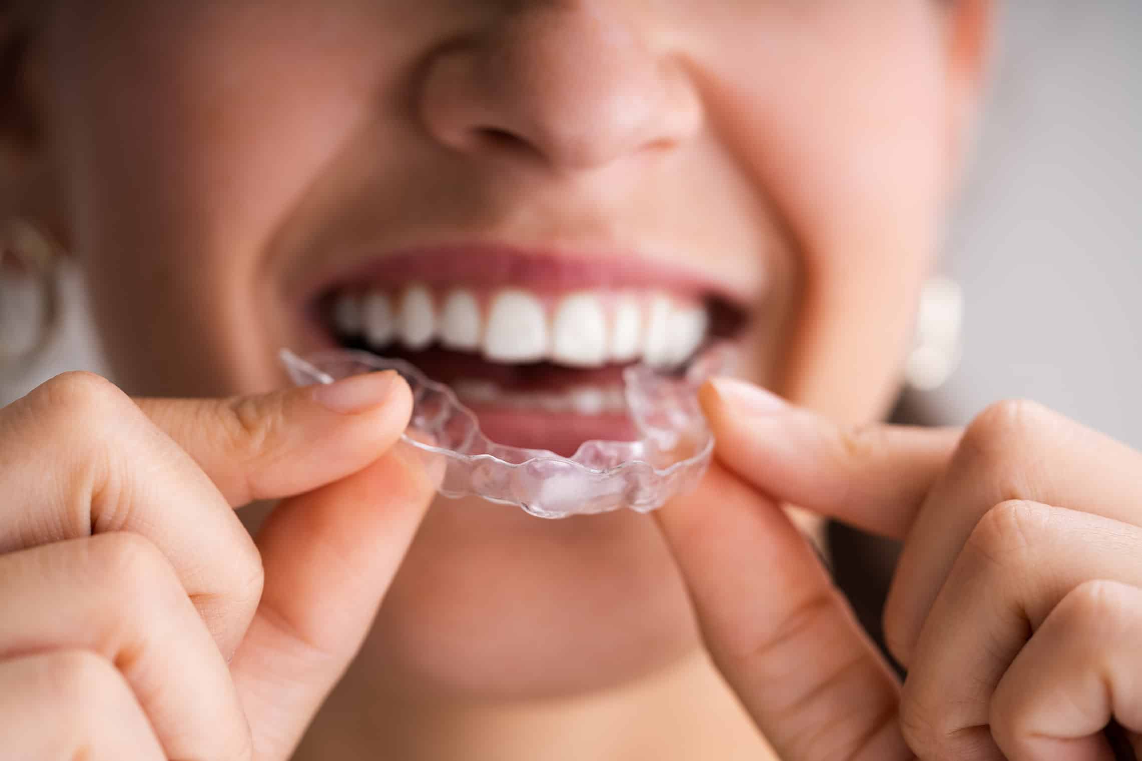 dental patient placing Invisalign Aligners into her teeth at oxford dental